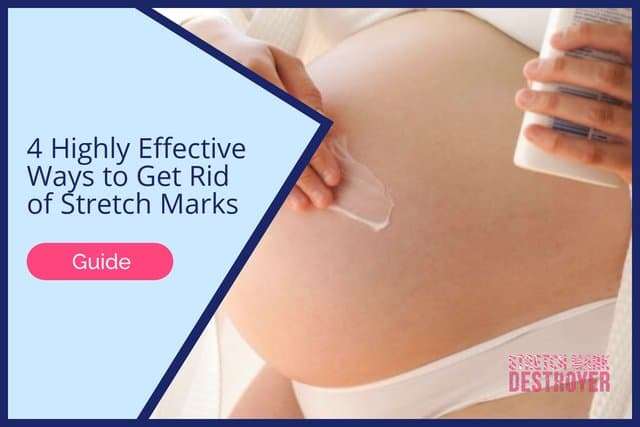 4 Highly Effective Ways to Get Rid of Stretch Marks