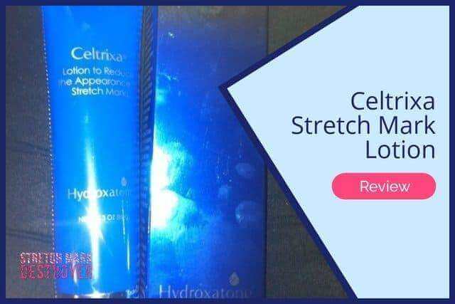 Hydroxatone Celtrixa Stretch Mark Lotion Review