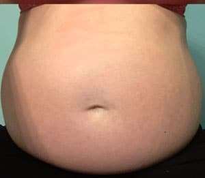 pregnant belly free of stretch marks